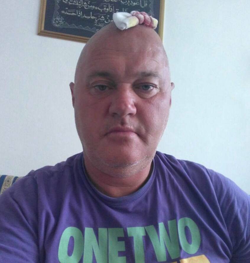 edin muzaferija fizicki napadnut1